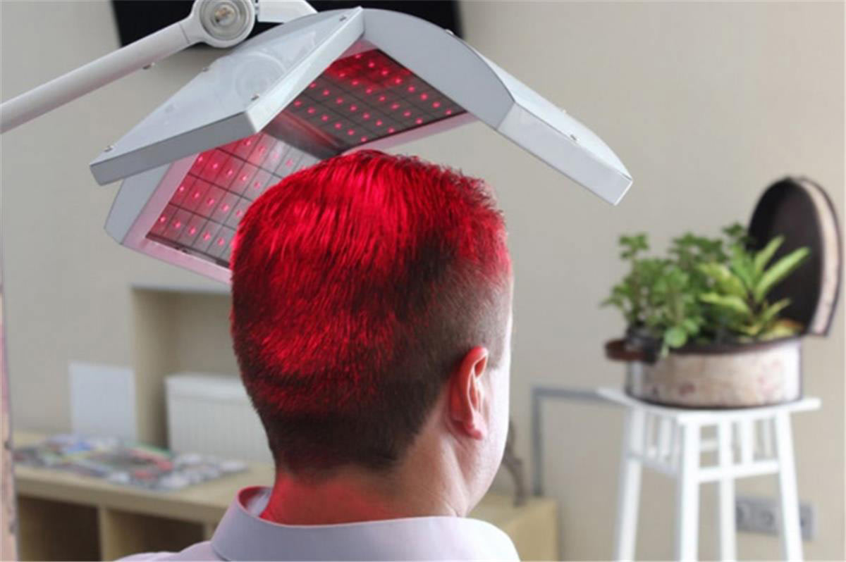 Tratamientos para frenar la caída del cabello